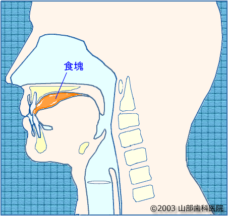 障害 嚥下