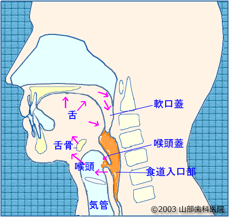 }-5