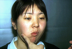 写真1：舌先で頬の内側から押す